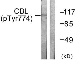 Antibody anti-CBL phospho TYR774 100 µg