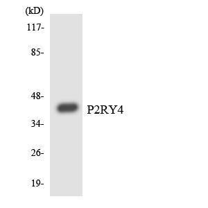 Western blot analysis of the lysates from COLO205 cells using Anti-P2RY4 Antibody