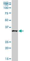 Anti-XAF1 Mouse Monoclonal Antibody [clone: 3E5]