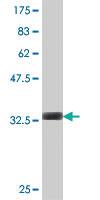 Anti-DUSP22 Mouse Polyclonal Antibody