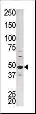 Anti-CDK16 Rabbit Polyclonal Antibody (PE (Phycoerythrin))