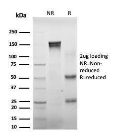 SDS-PAGE analysis of Anti-DAXX Antibody [PCRP-DAXX-8B7] under non-reduced and reduced conditions; showing intact IgG and intact heavy and light chains, respectively. SDS-PAGE analysis confirms the integrity and purity of the antibody.