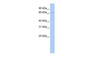 Antibody used in WB on Human MCF-7 at 0.2-1 µg/ml.