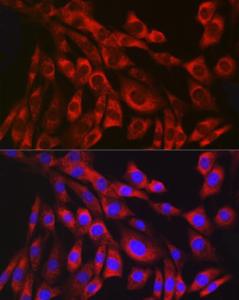 Immunofluorescence analysis of NIH/3T3 cells using Anti-Collagen III Antibody [ARC2542] (A308101) at a dilution of 1:100 DAPI was used to stain the cell nuclei (blue)