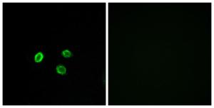 Anti-OR5M9 antibody