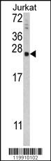 Anti-TPT1 Rabbit Polyclonal Antibody [clone: 362CT19.3.3]