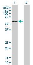 Anti-ATP6V1B2 Mouse Polyclonal Antibody