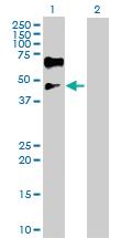 Anti-ISL1 Rabbit Polyclonal Antibody