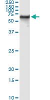 Anti-STK33 Mouse Monoclonal Antibody [clone: 4F7]