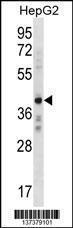 Anti-AEBP2 Rabbit Polyclonal Antibody (FITC (Fluorescein Isothiocyanate))