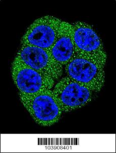 Anti-PFKM Rabbit Polyclonal Antibody (HRP (Horseradish Peroxidase))