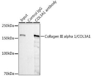 Immunoprecipitation analysis of 300 µg extracts of HepG2 cells using 3 µg of Anti-Collagen III Antibody [ARC2542] (A308101) This Western blot was performed on the immunoprecipitate using Anti-Collagen III Antibody [ARC2542] (A308101) at a dilution of 1:1000