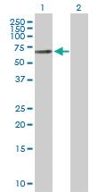 Anti-PLAT Rabbit Polyclonal Antibody