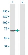 Anti-MSLN Mouse Polyclonal Antibody