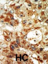 Anti-MAP Kinase 12 Rabbit Polyclonal Antibody (HRP (Horseradish Peroxidase))