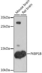 Anti-Calstabin-2 Rabbit Polyclonal Antibody