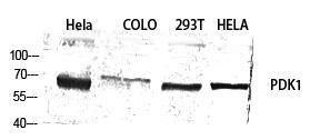 Western blot analysis of various cells using Anti-PDK1 Antibody