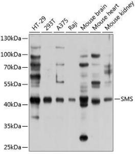 Western blot analysis of extracts of various cell lines, using Anti-Spermine synthase Antibody (A12344) at 1:1000 dilution