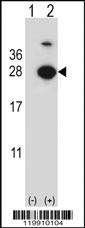 Anti-TPT1 Rabbit Polyclonal Antibody [clone: 362CT19.3.3]