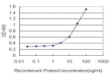 Anti-ATP6V1B2 Mouse Monoclonal Antibody [clone: M1]