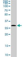 Anti-EPCR Rabbit Polyclonal Antibody