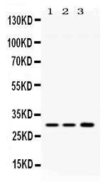 Anti-AQP11 Rabbit Polyclonal Antibody