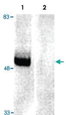 Anti-PARK2 Rabbit Polyclonal Antibody