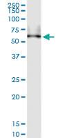 Anti-SIGIRR Polyclonal Antibody Pair