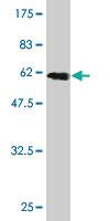 Anti-RLBP1 Mouse Monoclonal Antibody [clone: 4H5]