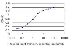 Anti-FOXA1 Mouse monoclonal antibody [clone: 4F6]