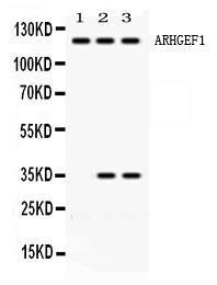 Anti-ARHGEF1 Rabbit Polyclonal Antibody