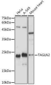 Western blot analysis of extracts of various cell lines, using Anti-TAGLN2 Antibody (A306954) at 1:1,000 dilution. The secondary antibody was Goat Anti-Rabbit IgG H&L Antibody (HRP) at 1:10,000 dilution.