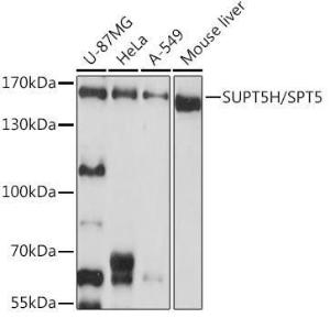 Western blot analysis of extracts of various cell lines, using Anti-SPT5 Antibody (A12346) at 1:1,000 dilution. The secondary antibody was Goat Anti-Rabbit IgG H&L Antibody (HRP) at 1:10,000 dilution.