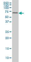 Anti-FGR Mouse Monoclonal Antibody [clone: 3B11]