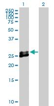 Anti-EPCR Rabbit Polyclonal Antibody