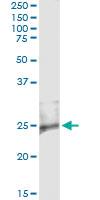 Anti-RASD2 Antibody Pair