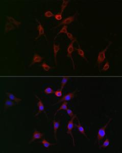 Immunofluorescence analysis of BALB-3T3 cells using Anti-TAGLN2 Antibody (A306954) at a dilution of 1:100 (40x lens). DAPI was used to stain the cell nuclei (blue).