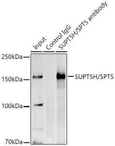 Immunoprecipitation analysis of 300µg extracts of HeLa cells using 3µg of Anti-SPT5 Antibody (A12346). This Western blot was performed on the immunoprecipitate using Anti-SPT5 Antibody (A12346) at a dilution of 1:500.