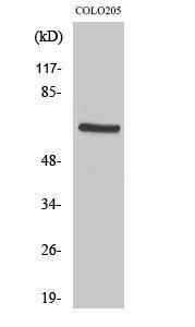 Western blot analysis of COLO205 cells using Anti-PDK1 Antibody