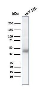 Western blot analysis of HCT116 cell lysate using Anti-Cytokeratin 8 Antibody [K8.8]