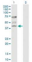 Anti-ATP6V1C1 Rabbit Polyclonal Antibody