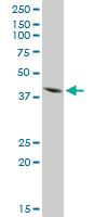 Anti-ISL1 Rabbit Polyclonal Antibody