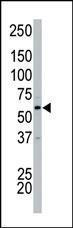 Anti-CDK17 Rabbit Polyclonal Antibody (PE (Phycoerythrin))