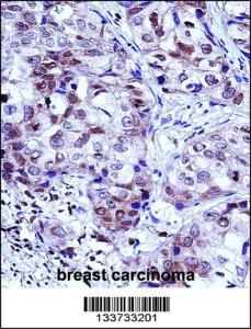 Anti-HIST1H1D Rabbit Polyclonal Antibody (FITC (Fluorescein Isothiocyanate))