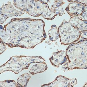 Immunohistochemistry analysis of paraffin-embedded human placenta using Anti-Placental lactogen Antibody [ARC2426] (A306956) at a dilution of 1:100 (40x lens). Perform microwave antigen retrieval with 10 mM Tris/EDTA buffer pH 9.0 before commencing with IHC staining protocol.