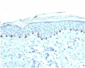 Immunohistochemical analysis of formalin-fixed, paraffin-embedded human skin tissue using Anti-Tyrosinase Antibody [TYR/3826] at 2 µg/ml