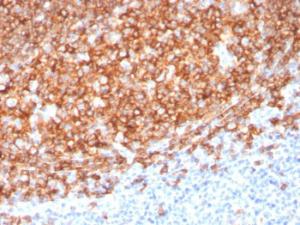 Anti-CD20 antibody