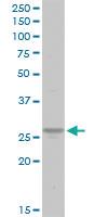 Anti-ATP6V1E1 Rabbit Polyclonal Antibody