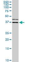 Anti-ISL1 Mouse Monoclonal Antibody [clone: 1A3]