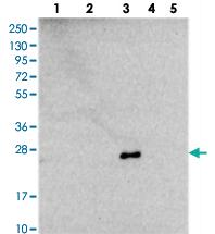 Anti-NDUFB9 Rabbit Polyclonal Antibody